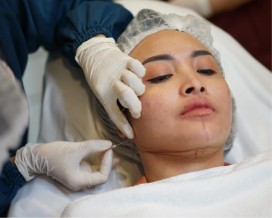 Pasien sedang melakukan treatment double needle thread