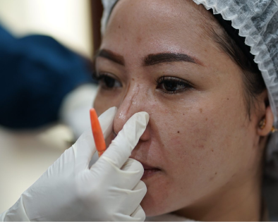 Pasien sedang melakukan treatment nose evo